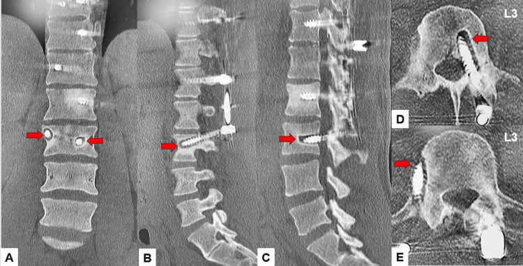 Figure 15