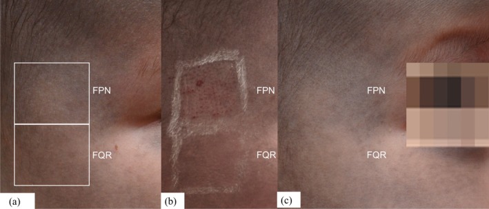FIGURE 2
