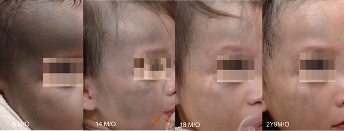 FIGURE 3