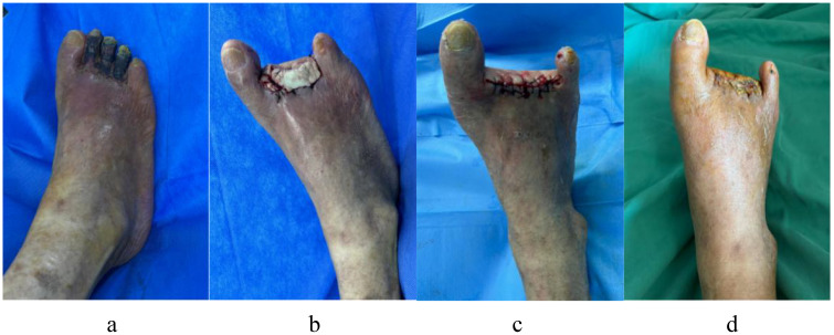 Figure 10