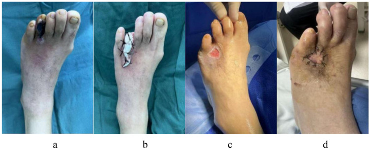 Figure 11