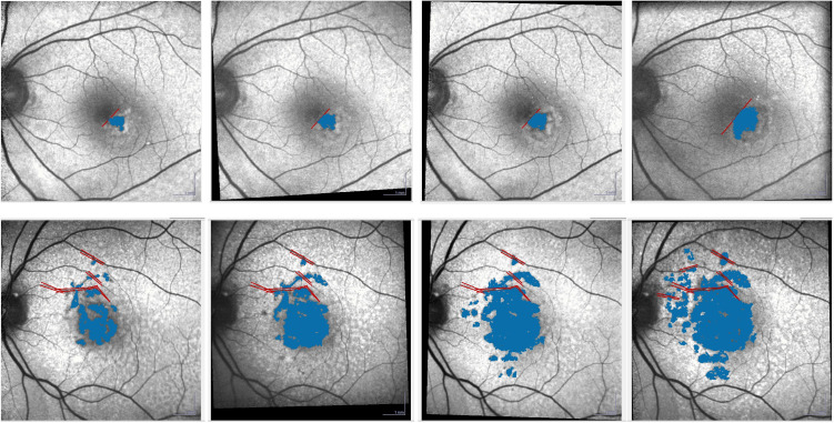 Fig 1