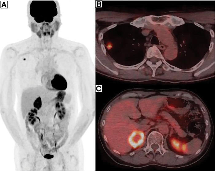 Fig. 2