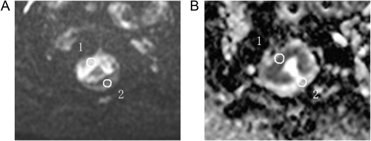 Figure 2