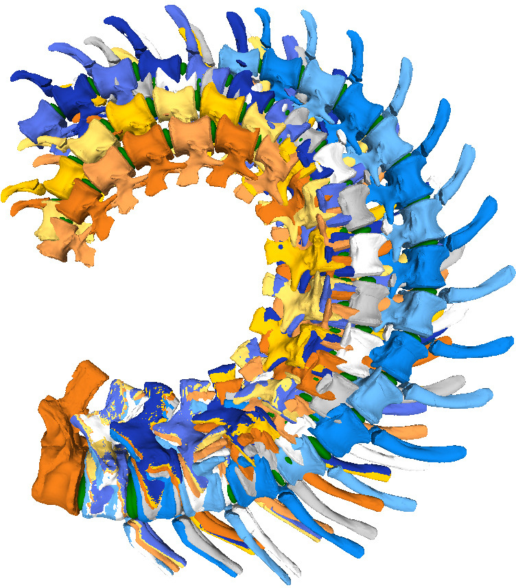 Figure 11