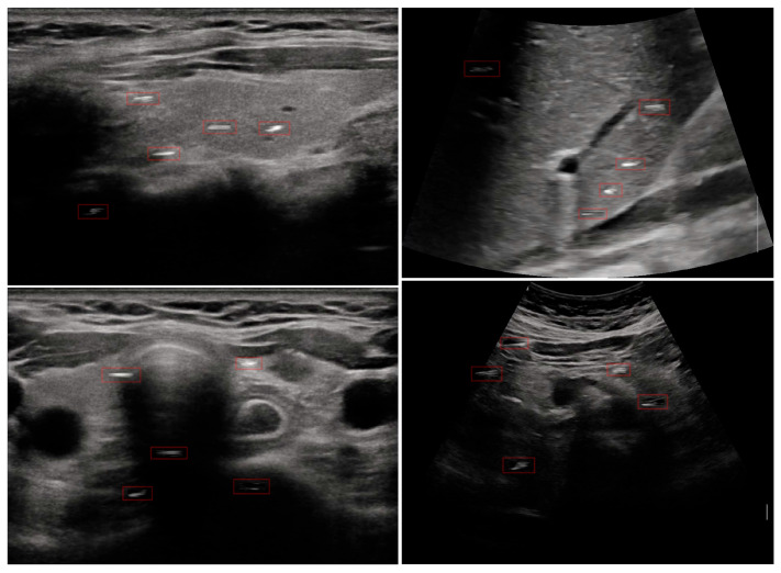 Figure 6