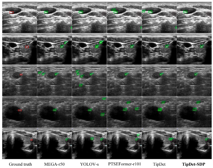 Figure 14