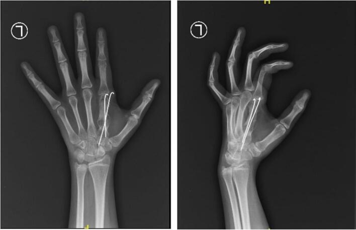 Figure 6