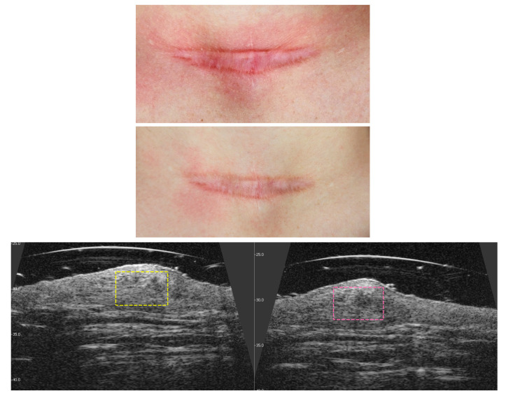 Figure 11