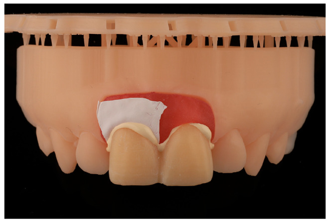 Figure 9