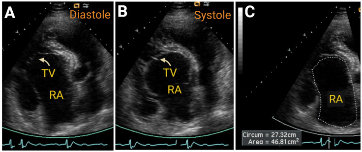 Figure 13