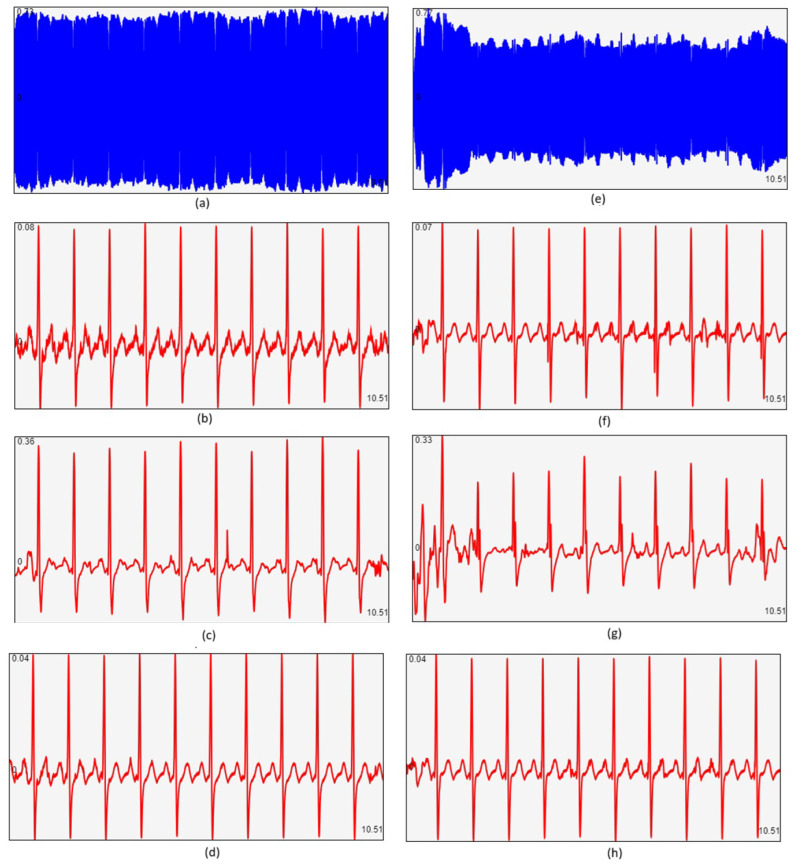 Figure 11