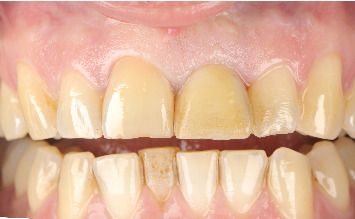 Figure 13
