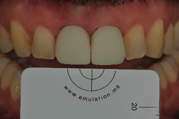 Figure 17