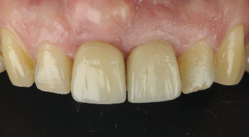 Figure 18