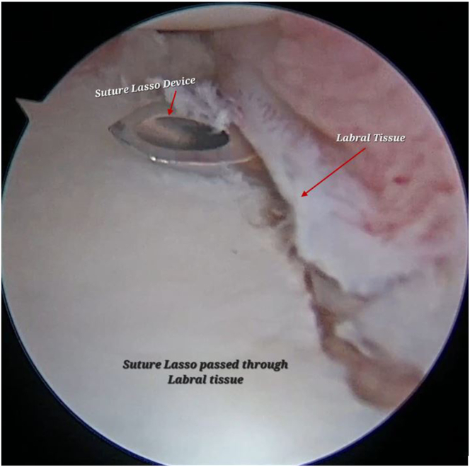 Figure 11
