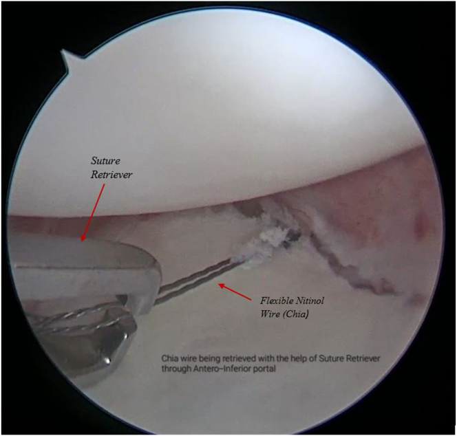 Figure 12