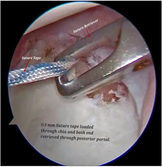 Figure 13