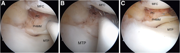 Figure 14