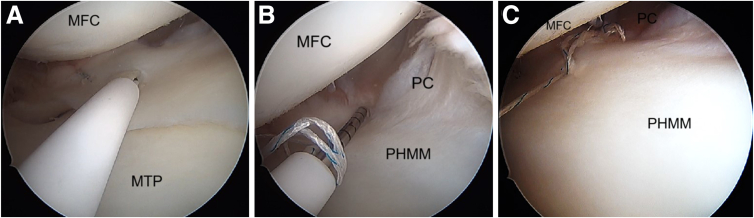 Figure 15