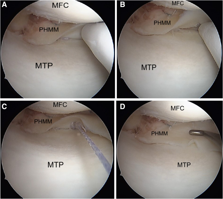 Figure 16