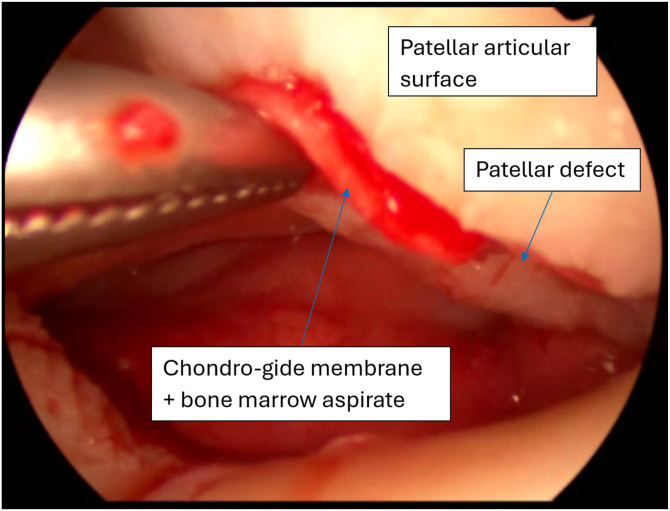 Figure 6