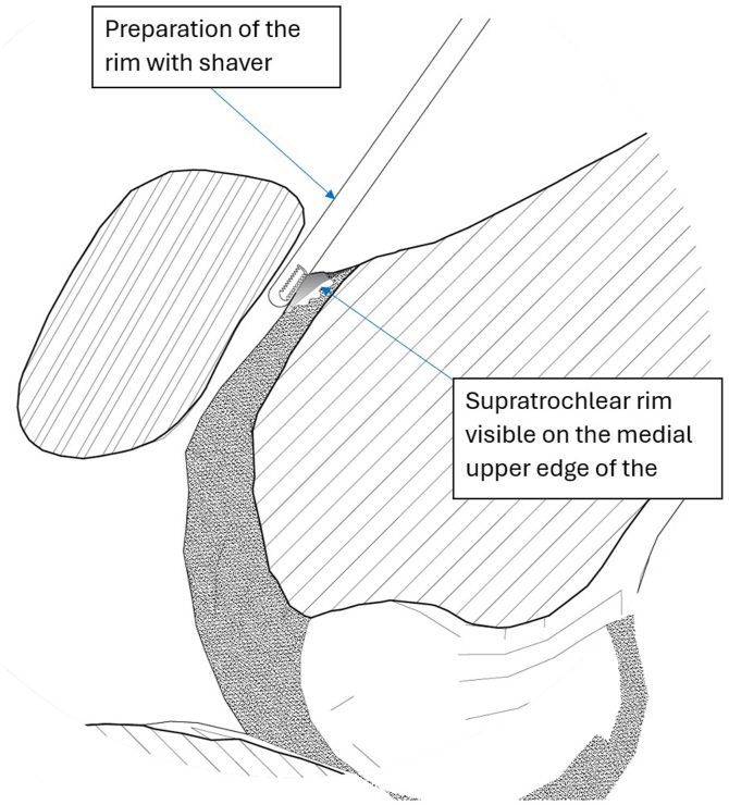 Figure 14