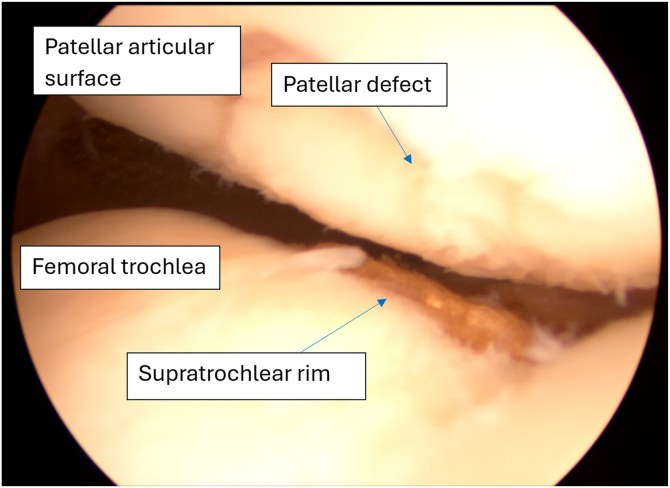 Figure 15