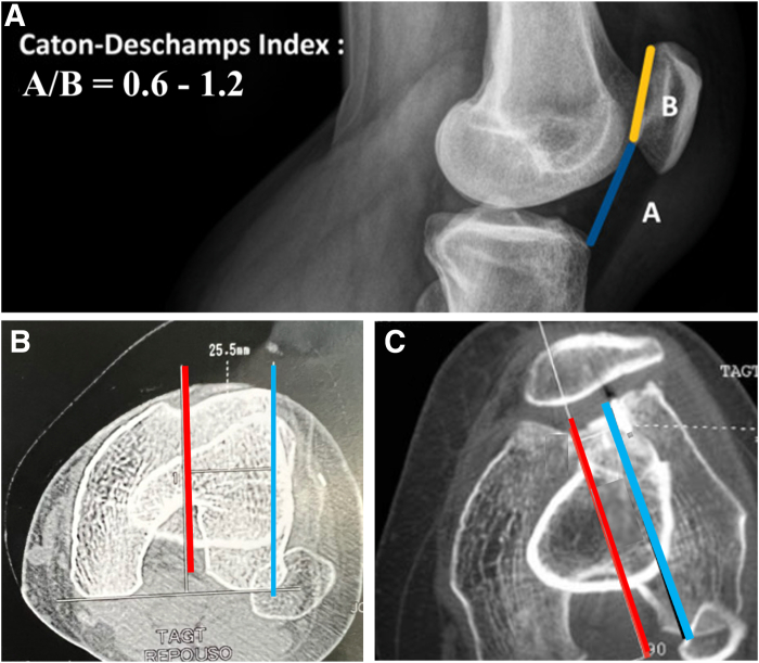 Figure 9