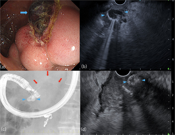 FIGURE 3