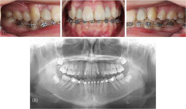 Figure 2