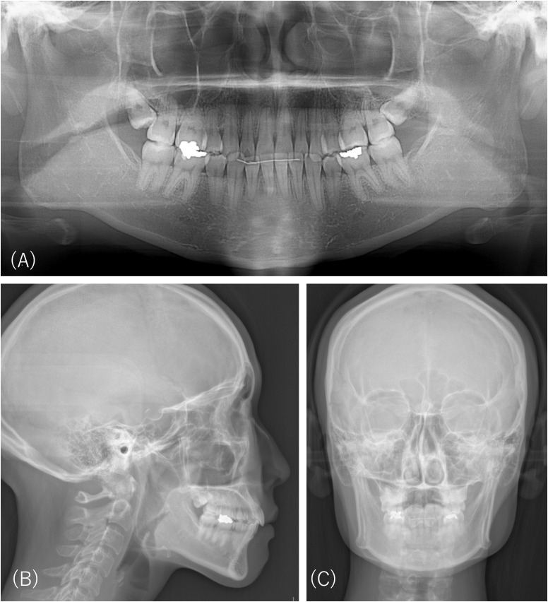 Figure 3