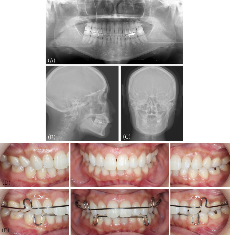 Figure 4