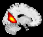 Figure 22