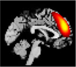 Figure 26