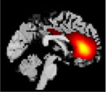 Figure 28