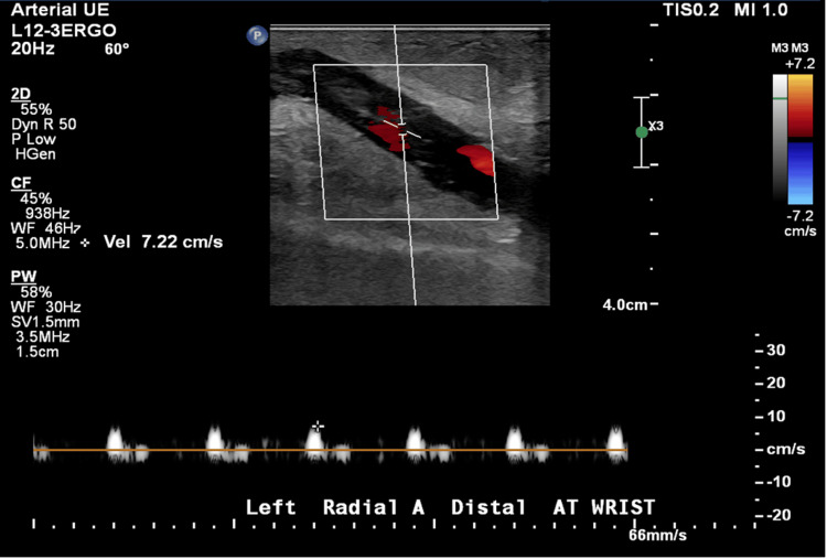 Figure 4