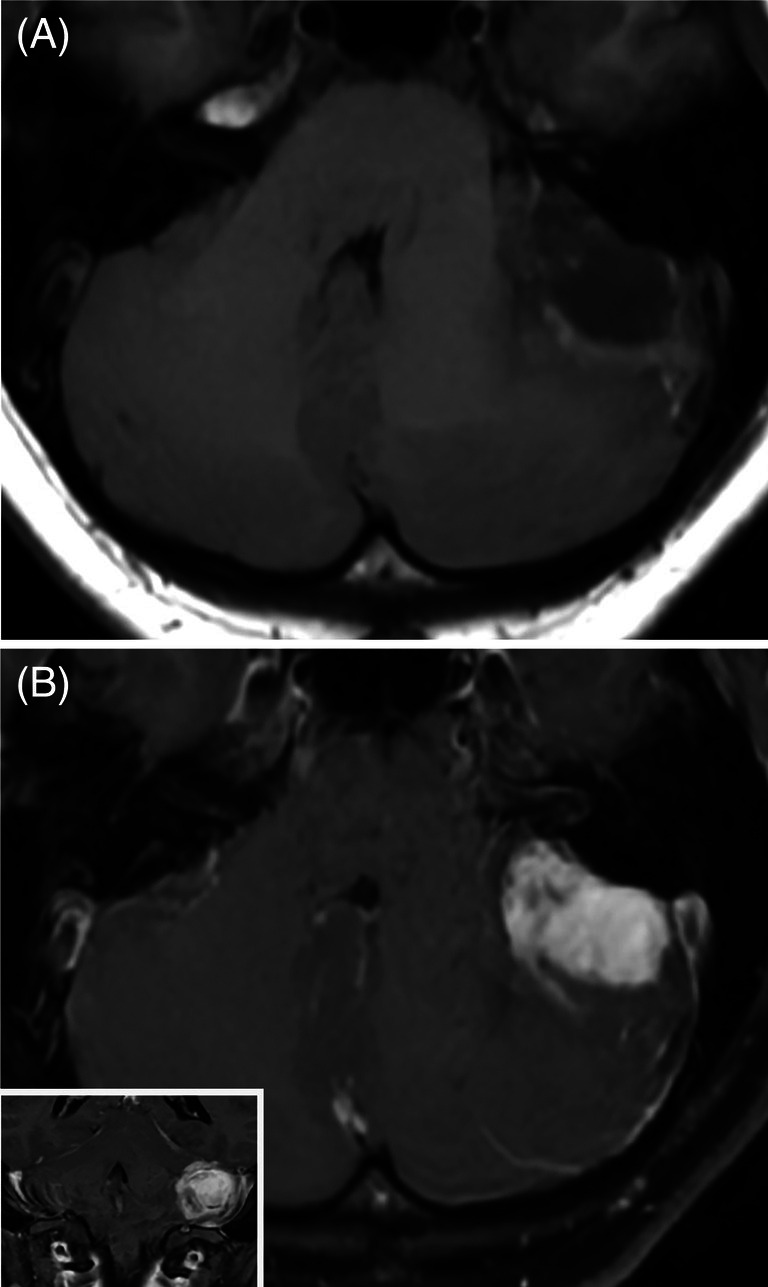 FIGURE 1