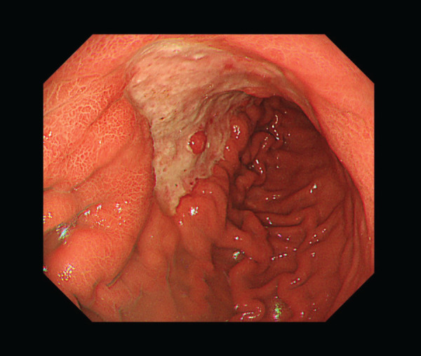 Fig. 1