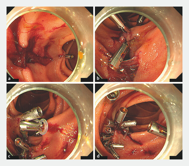 Fig. 2