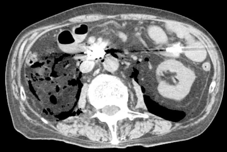 Fig. 4