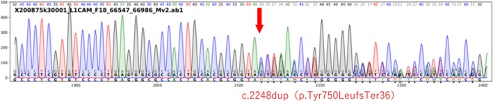 FIGURE 4