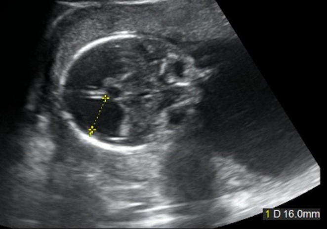 FIGURE 1