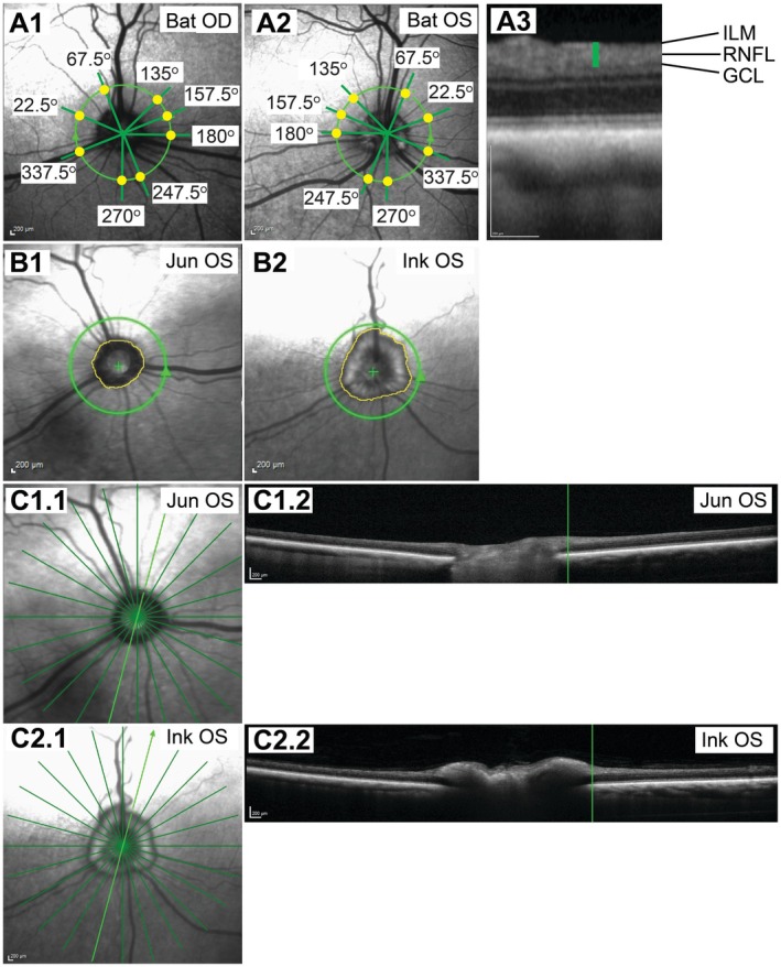 FIGURE 1