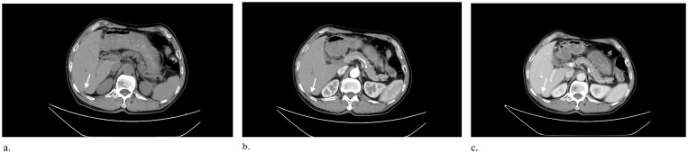 Figure 1