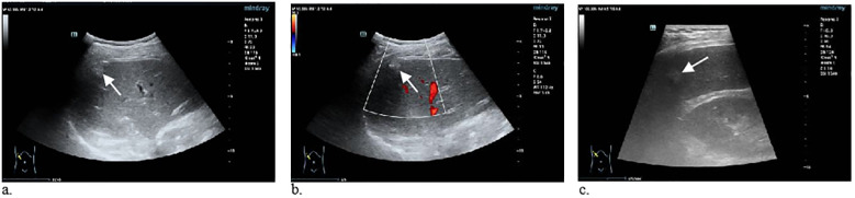 Figure 2