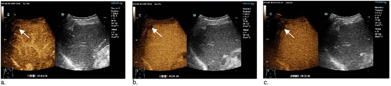 Figure 3