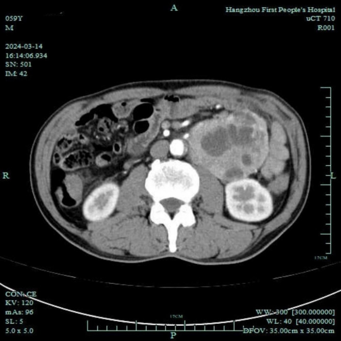 Figure 1
