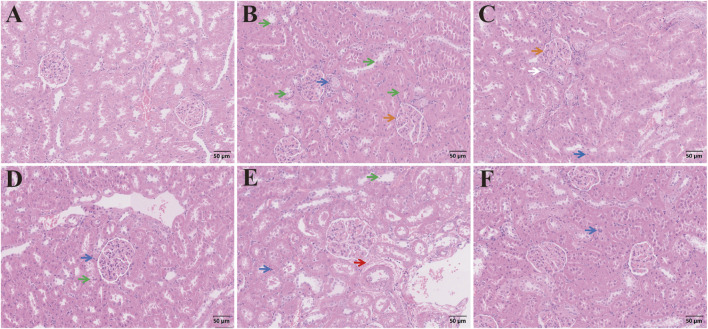FIGURE 14