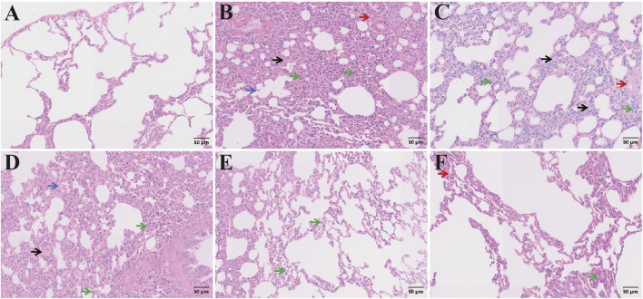 FIGURE 16